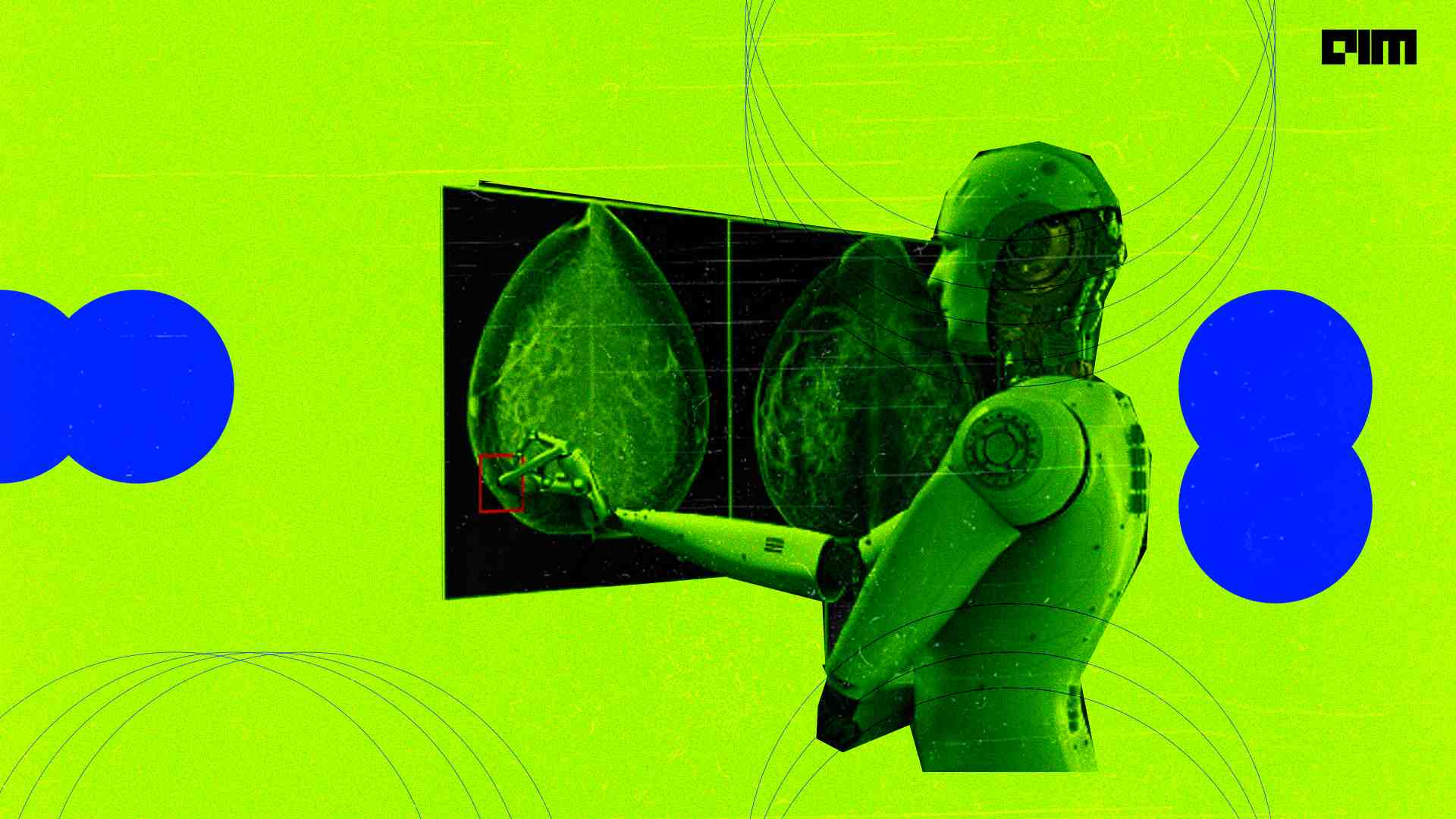 How AI is used for the early detection of breast cancer