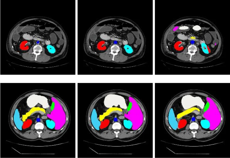 How Can TransUNet Improve Medical Image Segmentation? | Analytics India ...