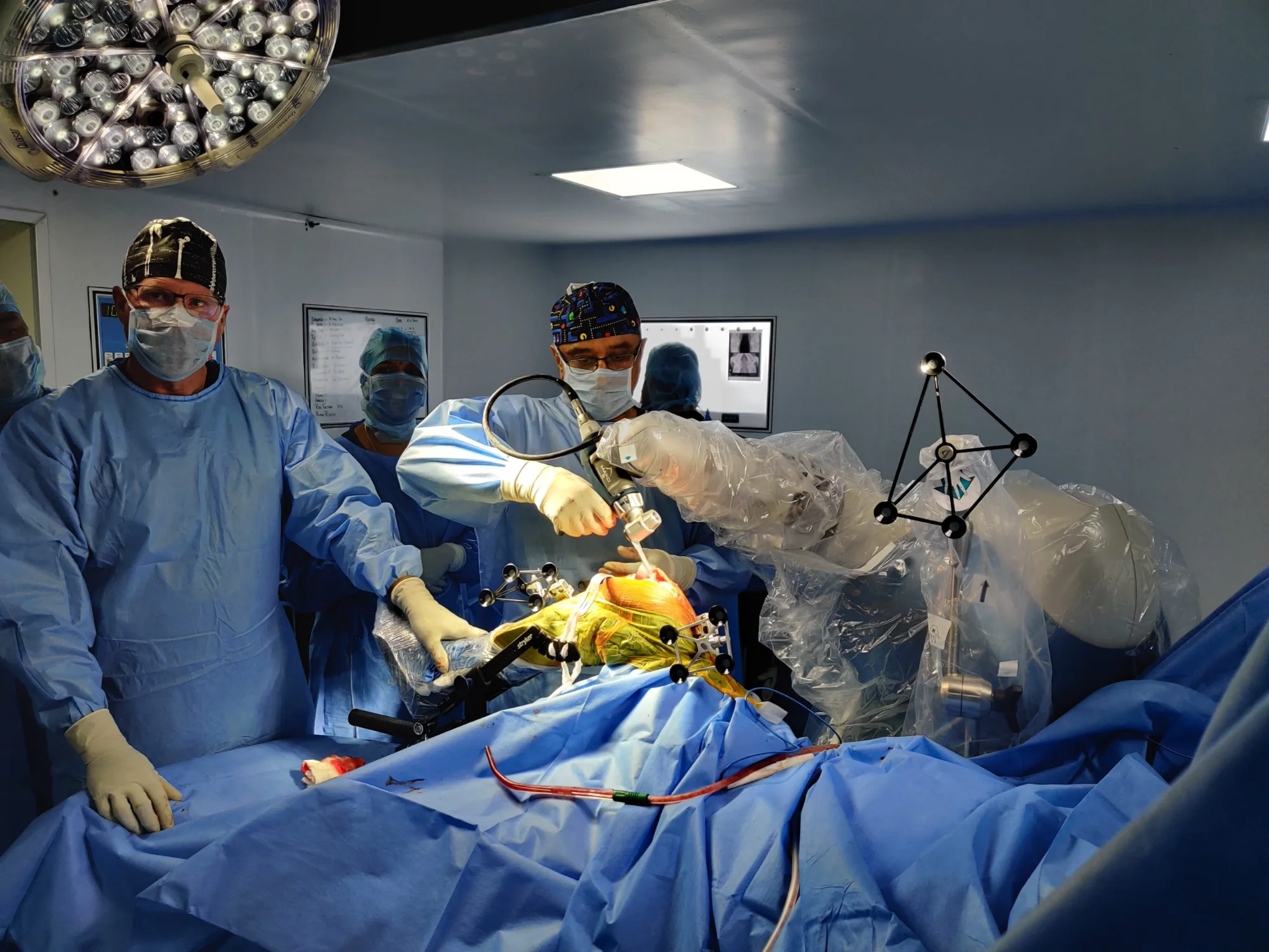 How is Robotic Arm Transforming Joint Replacement Surgeries? | AIM