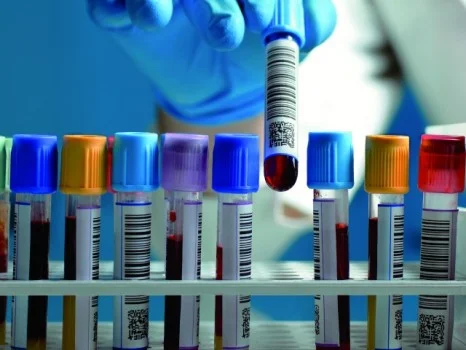 10 Most Popular Statistical Hypothesis Testing Methods Using Python