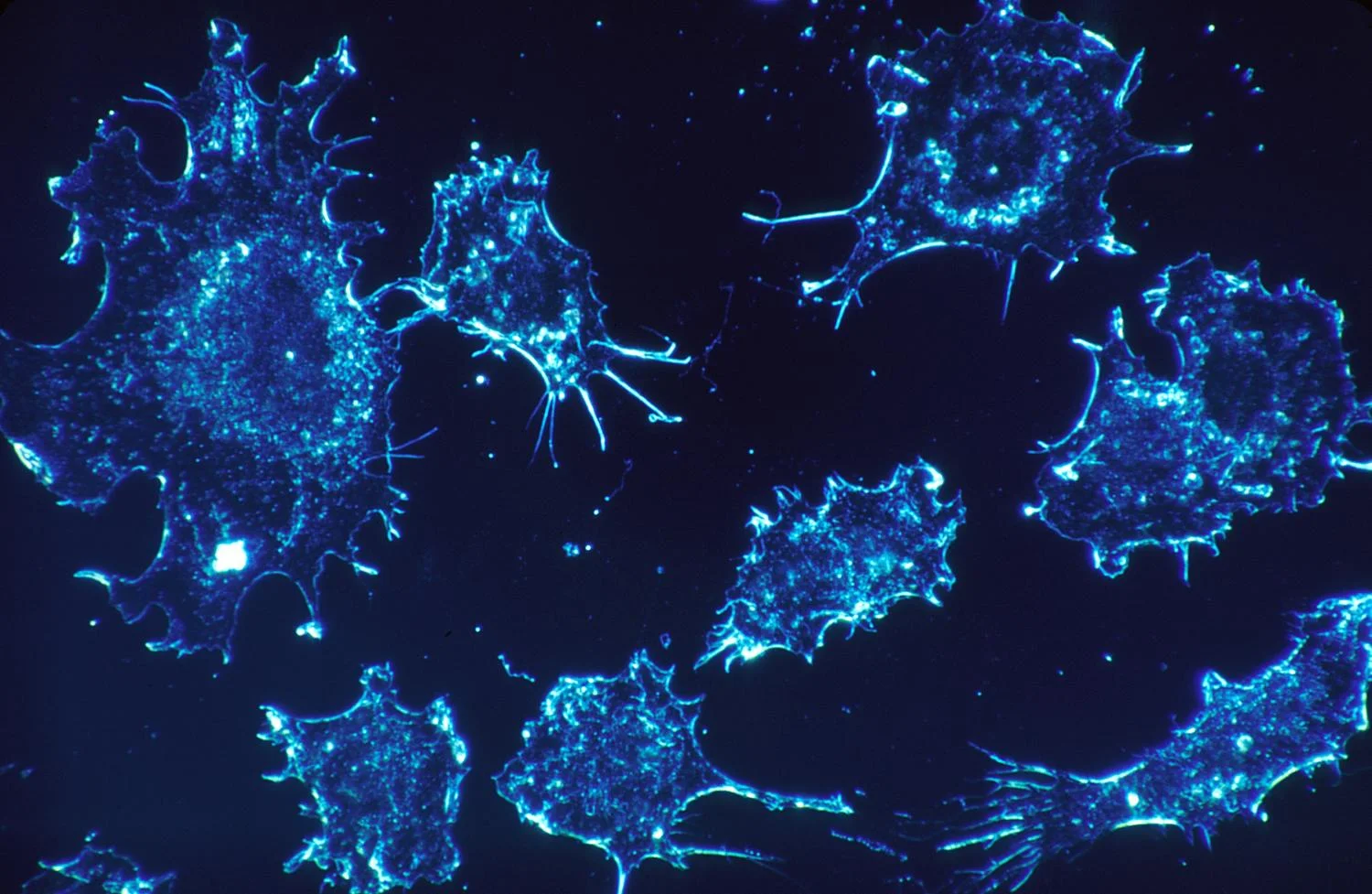 How Data Analytics Is Foraying Into Pancreatic Cancer Treatment